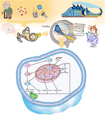 Potential therapeutic role of SIRT1 in age- related hearing loss